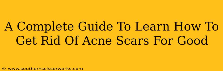 A Complete Guide To Learn How To Get Rid Of Acne Scars For Good